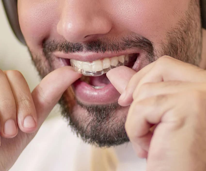 Person with invisible braces